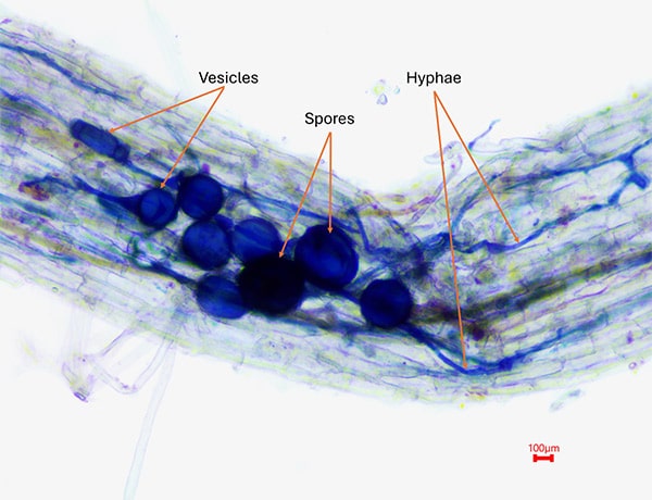 AMF structures (hyphae, vesicles and spores) observed in the roots of bluebunch wheatgrass collected at Cervo 2 on June 2025, at 100× magnification. Micrograph : Dale Pulvermacher, Mycology Research Laboratory, Lethbridge Polytechnic.